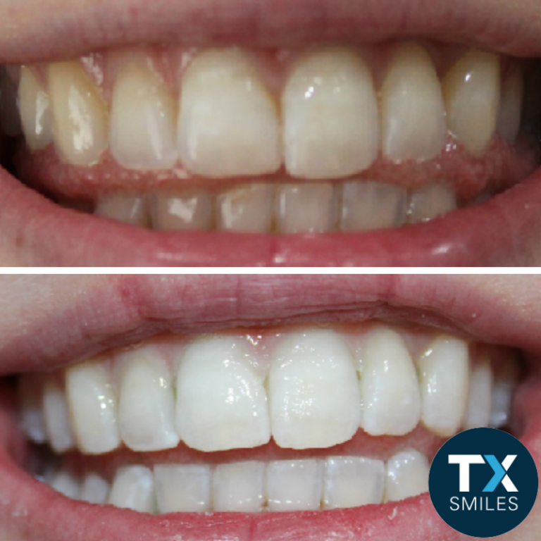 TX Smiles 12 768x768