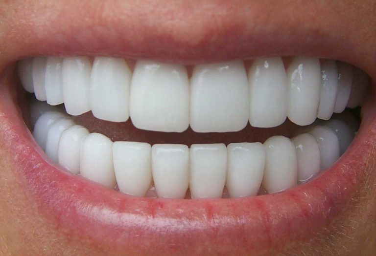 parkcitiesdental.com  768x524