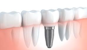 Dentist Cranbourne