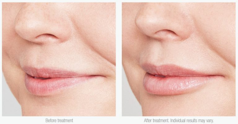 before and after 768x400