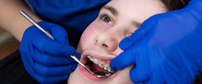 braces melbourne MP Orthodontics 768x322