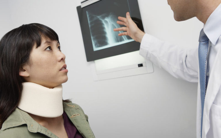 Public Liability Claims