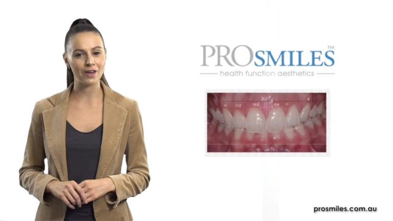 digital smile analysis 768x432