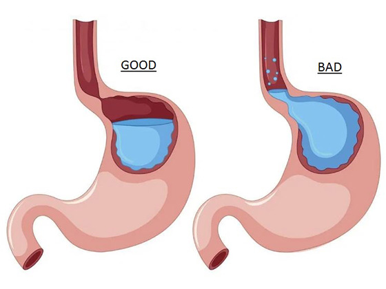 good vs bad 1