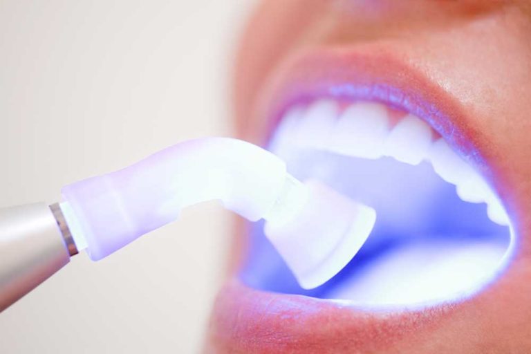 teeth checkup 768x512