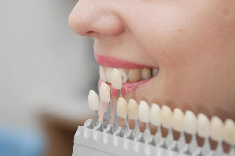 teeth 768x512
