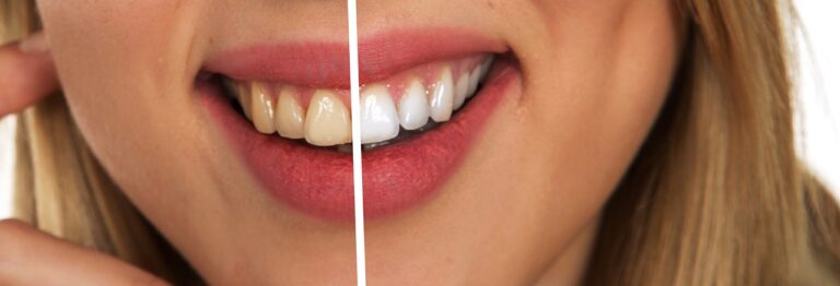17 Struggles People With Bad Teeth Know To Be True 768x262