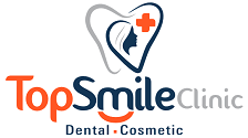 Top smile