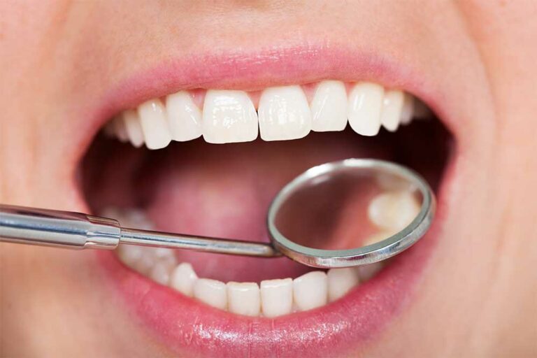 Your Gold Coast Dentist Dental Check Up 768x512