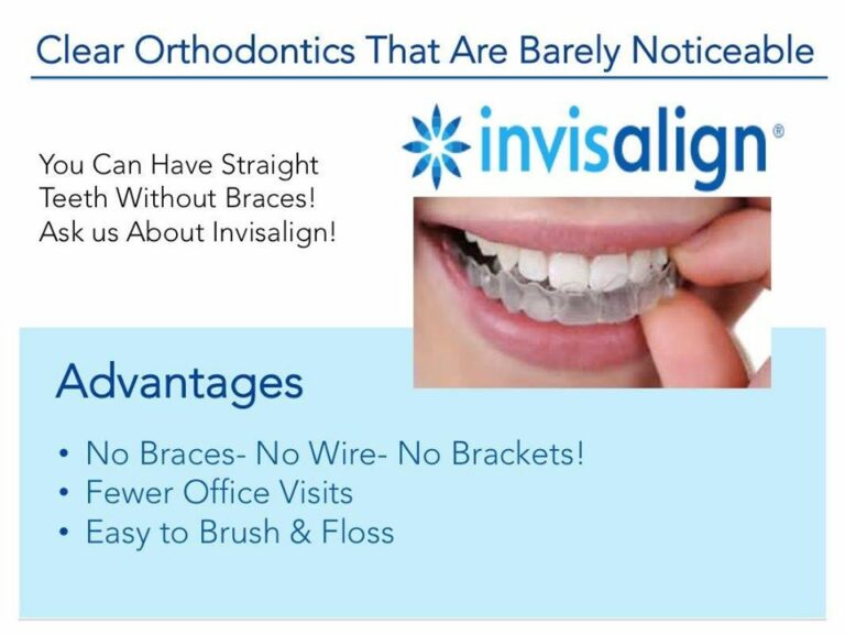 invisalign advantage 768x577