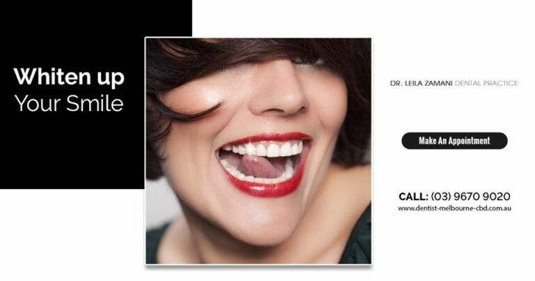 smile shines whiten up 768x403