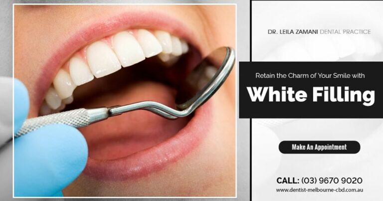 white filling teeth 768x403