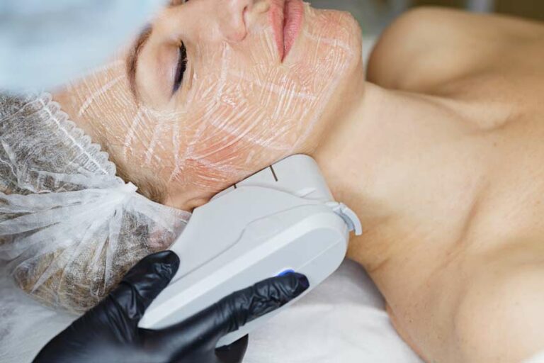 facial skin rejuvenation laser treatment 1 768x512