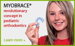 banner myobrace