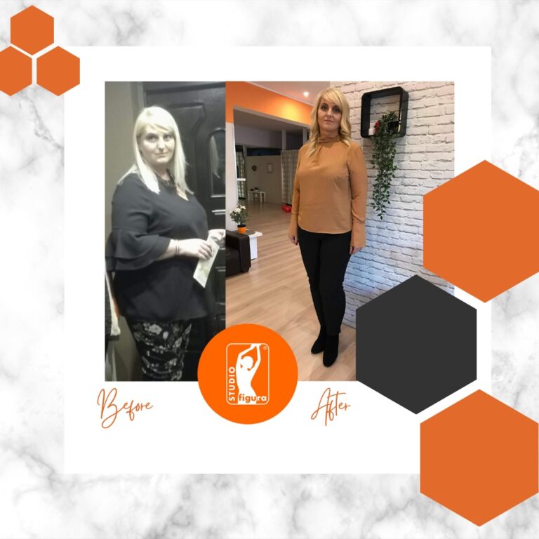 Non Surgical Facelift Treatment Newstead 768x768