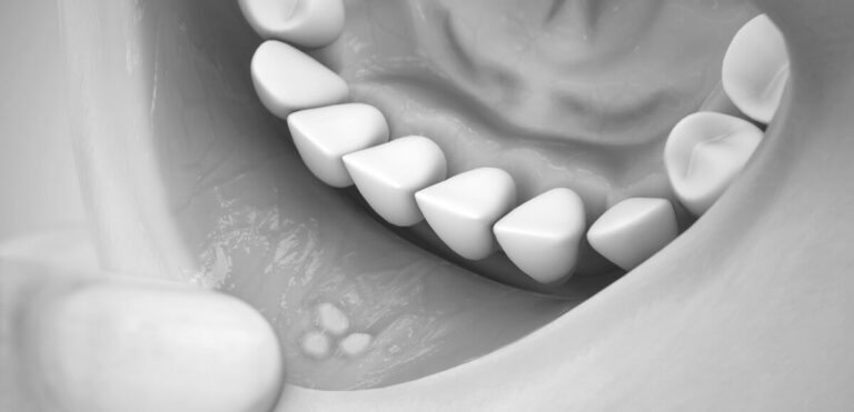 Cosmetic Dentistry Ballarat