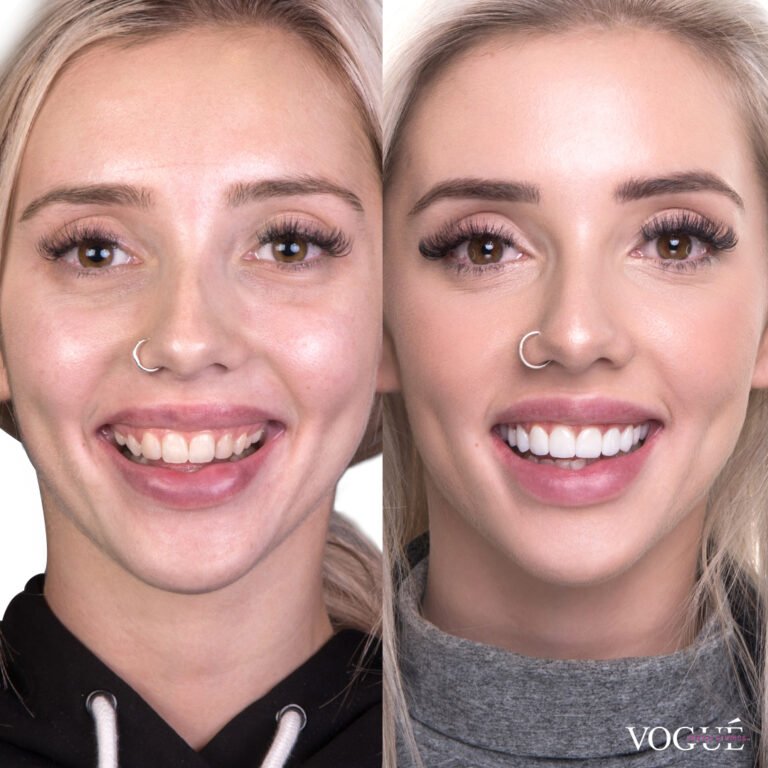 erin before after 768x768
