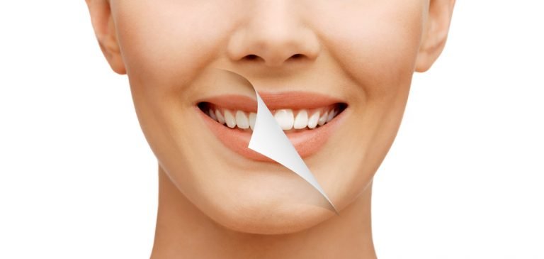 teethwhitening 768x365