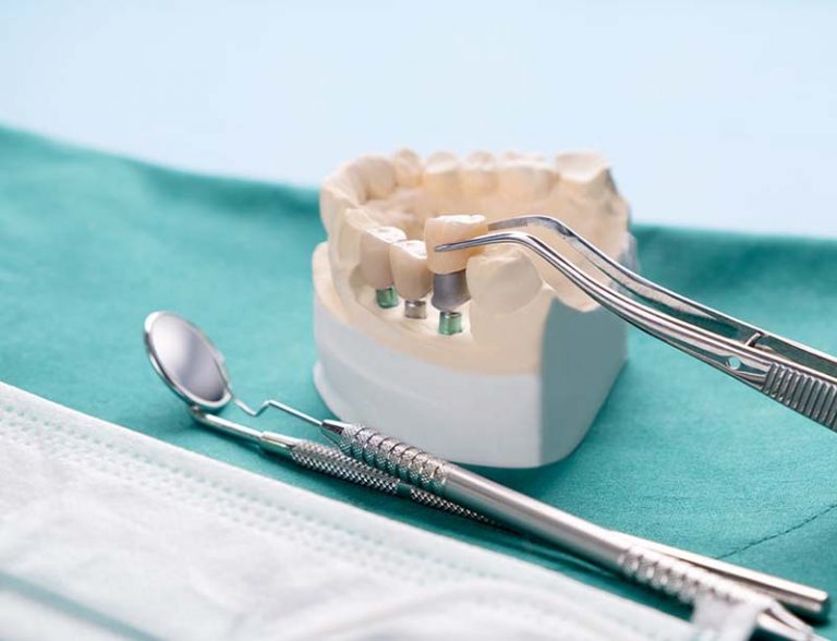 dentist annerley 3 768x588