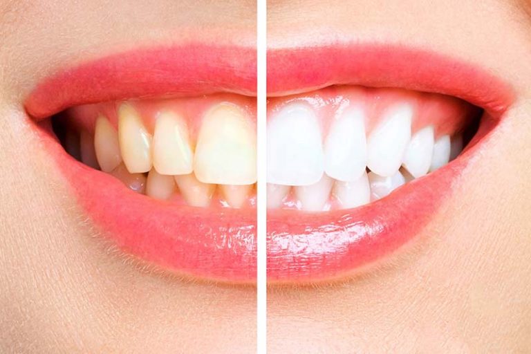 dentist annerley 5 768x512