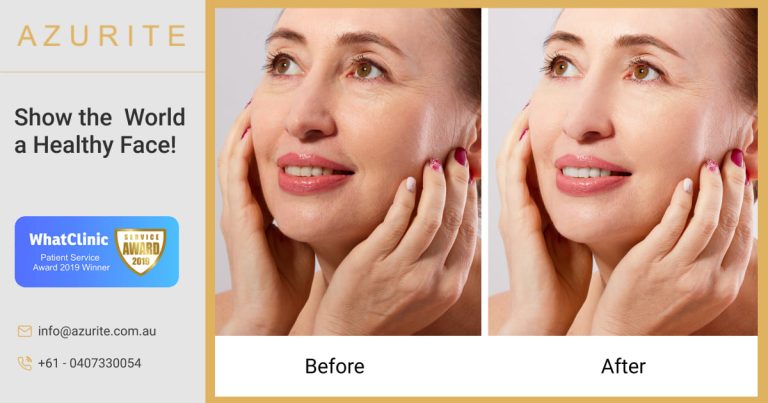 Facelift Cosmetic 768x403