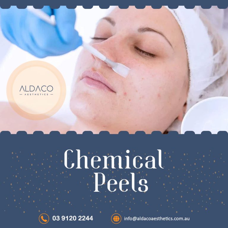 Chemical Peels at Aldaco Aesthetics 768x768