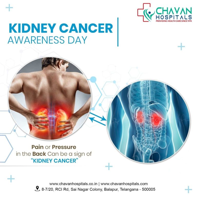 NEPHROLOGIST 768x768