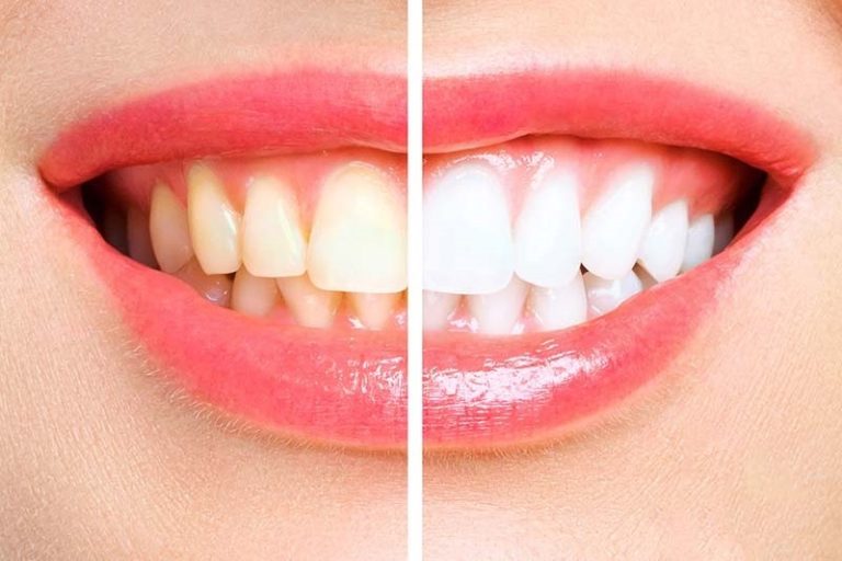 dentist annerley 5 768x512