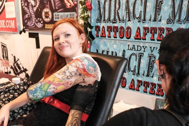 laser tattoo removal 768x512