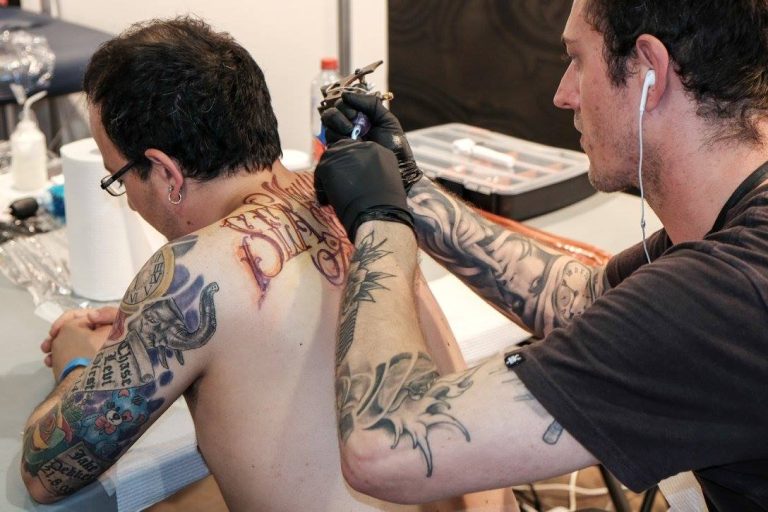 tattoo removal 768x512
