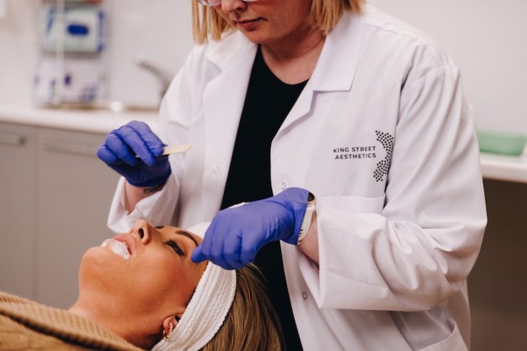 Lip Fillers 768x512