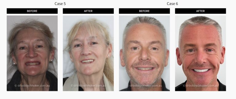 dentist bondi junction 768x324