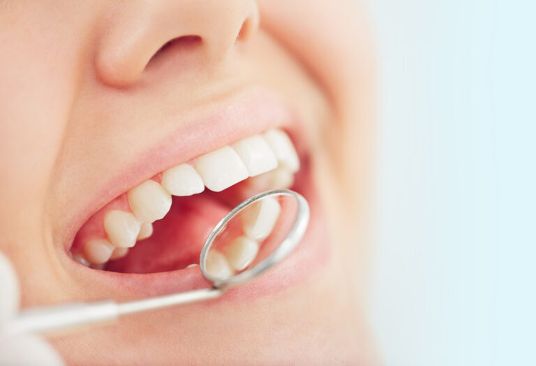 gbd dental 3 768x524